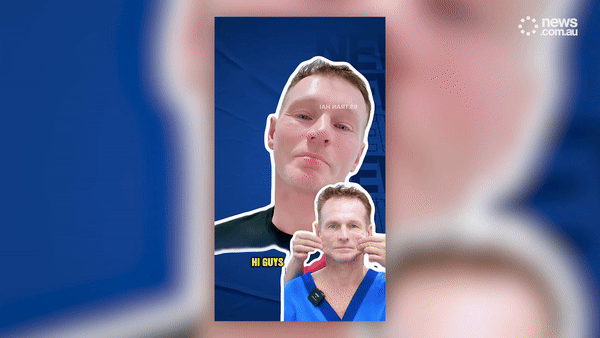 Người đàn ông Úc không chụp ảnh suốt 20 năm bỗng nổi tiếng sau khi đến Việt Nam phẫu thuật thẩm mỹ, điện thoại iPhone cũng không nhận diện được- Ảnh 1.