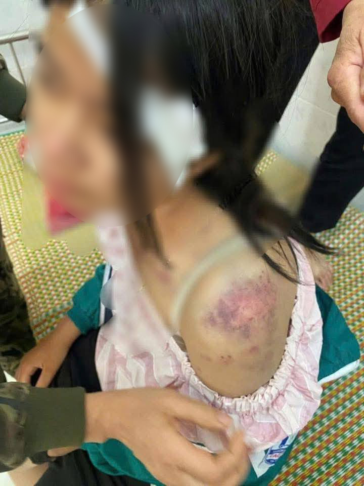 Hoàn cảnh cháu bé bị bà nội và 2 người đàn ông bạo hành: Bố mẹ ly hôn khi mới 1 tuổi, kể bị đánh 4 tiếng- Ảnh 1.