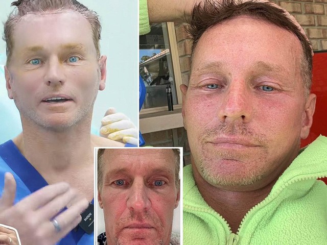 Người đàn ông Úc không chụp ảnh suốt 20 năm bỗng nổi tiếng sau khi đến Việt Nam phẫu thuật thẩm mỹ, điện thoại iPhone cũng không nhận diện được- Ảnh 4.