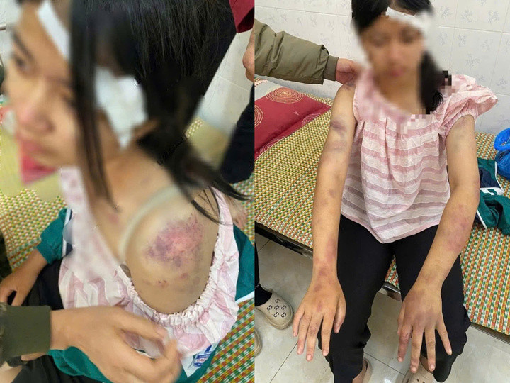 Khởi tố bà nội và 2 người đàn ông bạo hành dã man bé gái 13 tuổi ở Thái Nguyên- Ảnh 2.