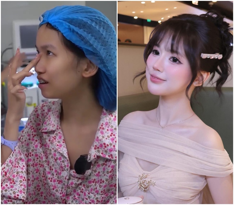 Gương mặt trước khi đụng dao kéo của dàn 