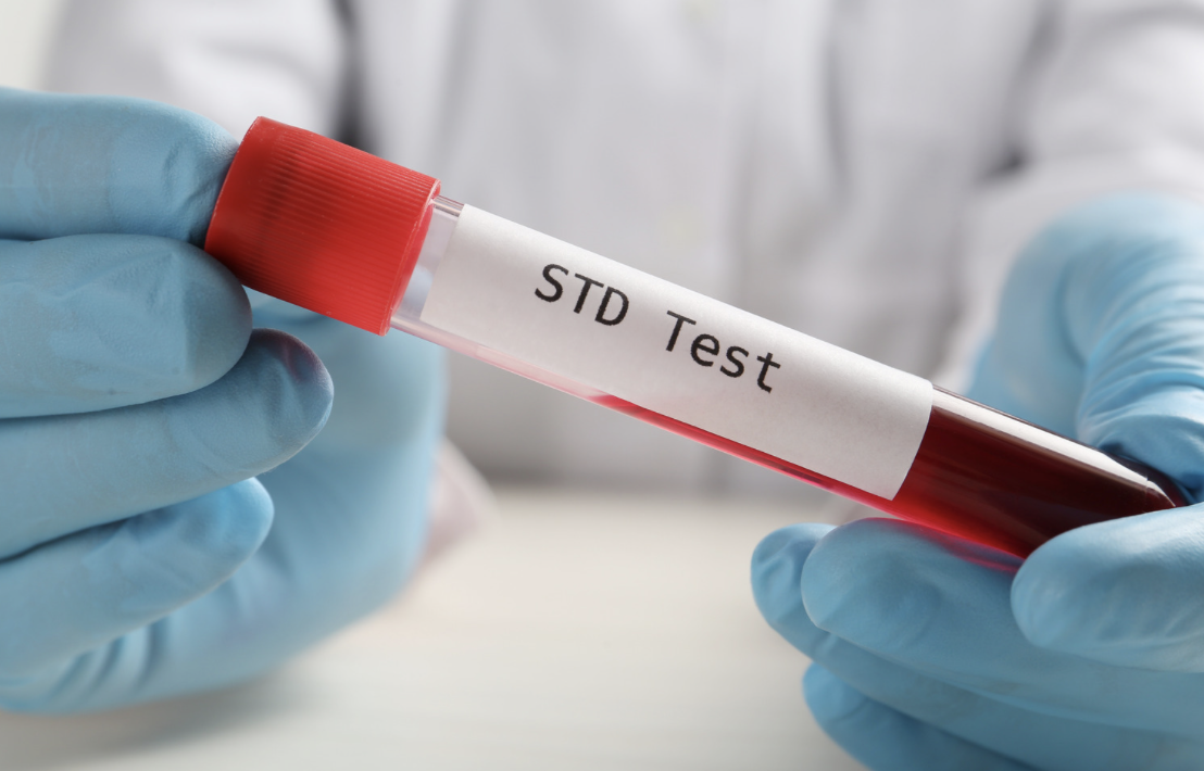 1 bệnh viện ở TP HCM ghi nhận 1 năm hơn 38.000 ca sùi mào gà- Ảnh 1. 1 bệnh viện ở TP HCM ghi nhận 1 năm hơn 38.000 ca sùi mào gà- Ảnh 1.