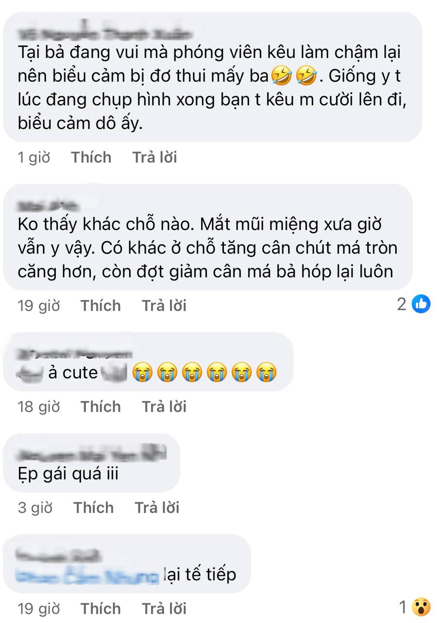 Cũng tới ngày Kim Ji Won bị soi quá đà: Mặt vậy mà vẫn chê?- Ảnh 3. Cũng tới ngày Kim Ji Won bị soi quá đà: Mặt vậy mà vẫn chê?- Ảnh 3.