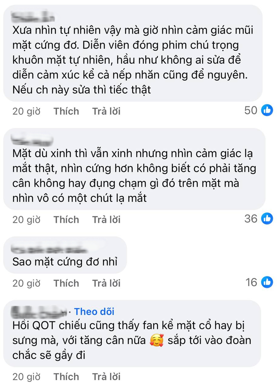 Cũng tới ngày Kim Ji Won bị soi quá đà: Mặt vậy mà vẫn chê?- Ảnh 2. Cũng tới ngày Kim Ji Won bị soi quá đà: Mặt vậy mà vẫn chê?- Ảnh 2.