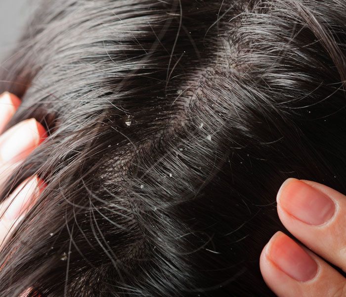 Vừa đắp mặt nạ, vừa ủ tóc mềm mượt: Loại nguyên liệu giá chỉ 5k này có thể làm đẹp từ da đến tóc- Ảnh 4. Vừa đắp mặt nạ, vừa ủ tóc mềm mượt: Loại nguyên liệu giá chỉ 5k này có thể làm đẹp từ da đến tóc- Ảnh 4.