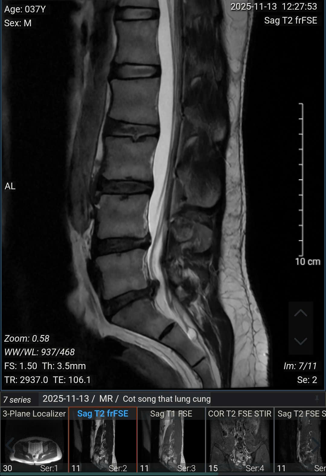 Người đàn ông 37 tuổi ở Hà Nội "nhận kết đắng" sau trận pickleball- Ảnh 2.
