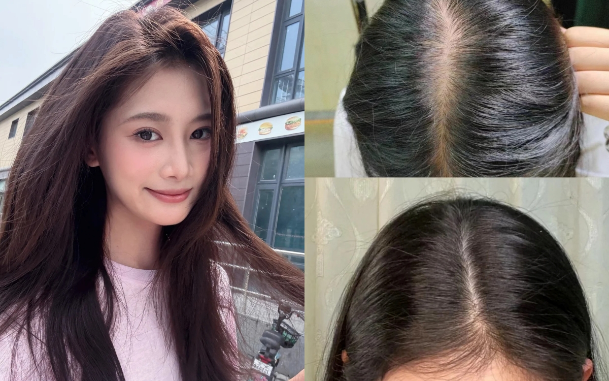 5 xịt mọc tóc "made in Vietnam" để tóc chắc khỏe từ gốc, không lo gãy rụng- Ảnh 1.