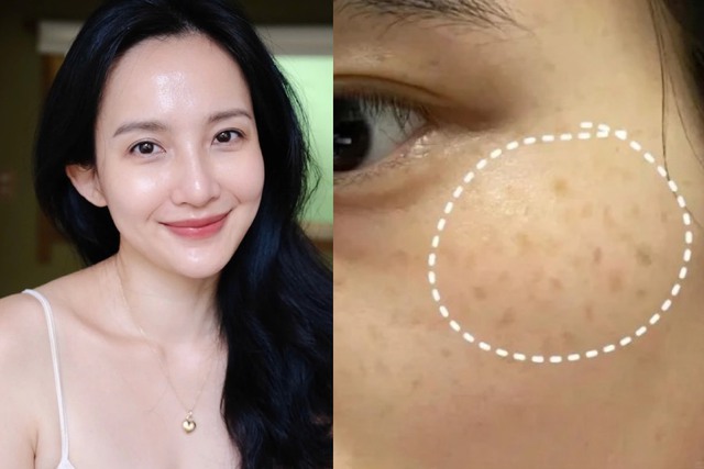 Kem trị nám trôi nổi đang phá hủy da nhiều người mua “nhẹ dạ”- Ảnh 6.