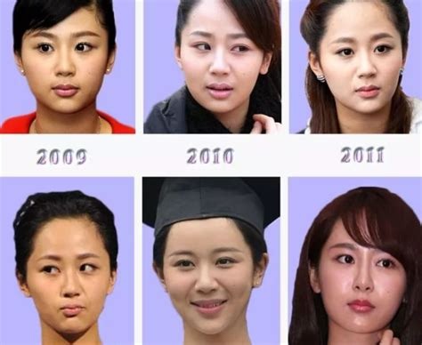 Dương Tử bị vạch trần sửa mặt quá khác so với thời xưa- Ảnh 6.