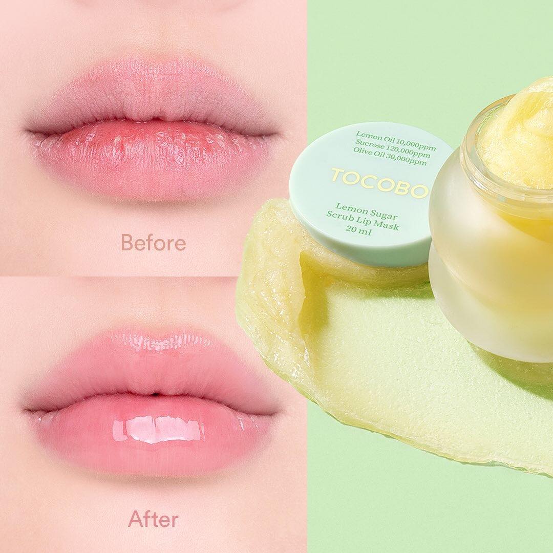 Chuyên viên thẩm mỹ viện 10 năm mách bạn mẹo trị môi khô tại nhà, rẻ mà hiệu quả bất ngờ- Ảnh 6.