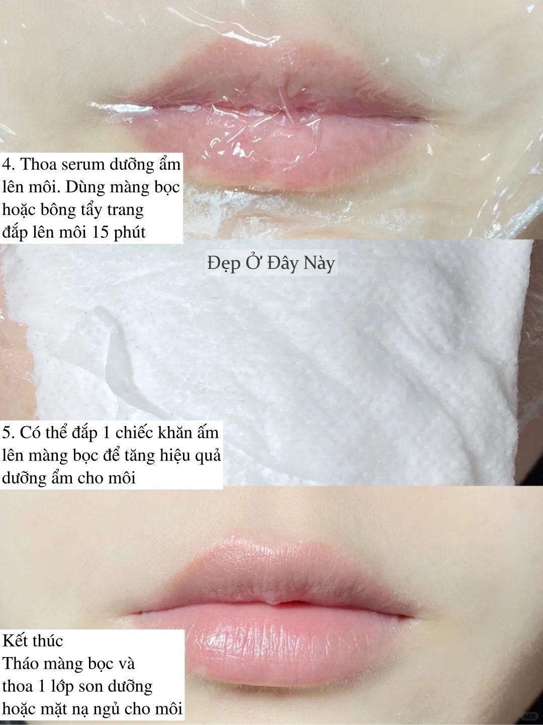 Chuyên viên thẩm mỹ viện 10 năm mách bạn mẹo trị môi khô tại nhà, rẻ mà hiệu quả bất ngờ- Ảnh 4.