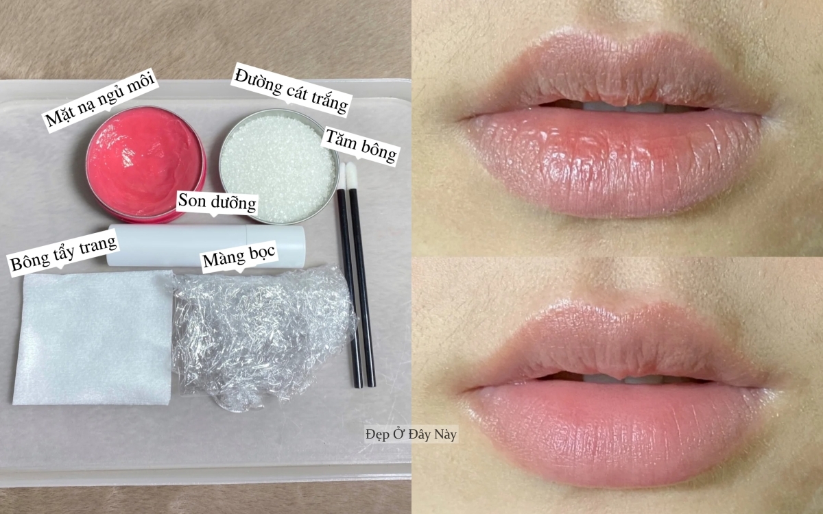 Chuyên viên thẩm mỹ viện 10 năm mách bạn mẹo trị môi khô tại nhà, rẻ mà hiệu quả bất ngờ- Ảnh 2.