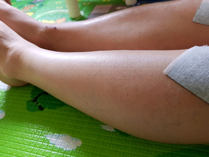 4 bất thường ở chân là dấu hiệu ung thư phổi dù nói ra có nhiều người CHẲNG  CHỊU TIN!