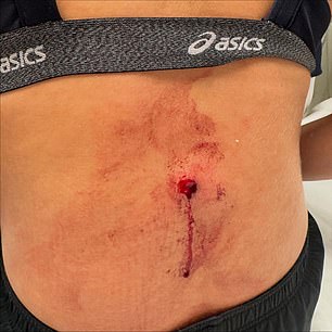 Nữ thần bóng chuyền thoát chết thần kì sau khi bị bắn trúng trong một vụ cướp- Ảnh 2. Nữ thần bóng chuyền thoát chết thần kì sau khi bị bắn trúng trong một vụ cướp- Ảnh 2.