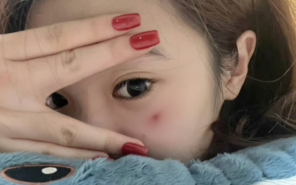 Một bất thường trên da đang cố TỐ CÁO ung thư máu nhưng lại bị đổ cho 