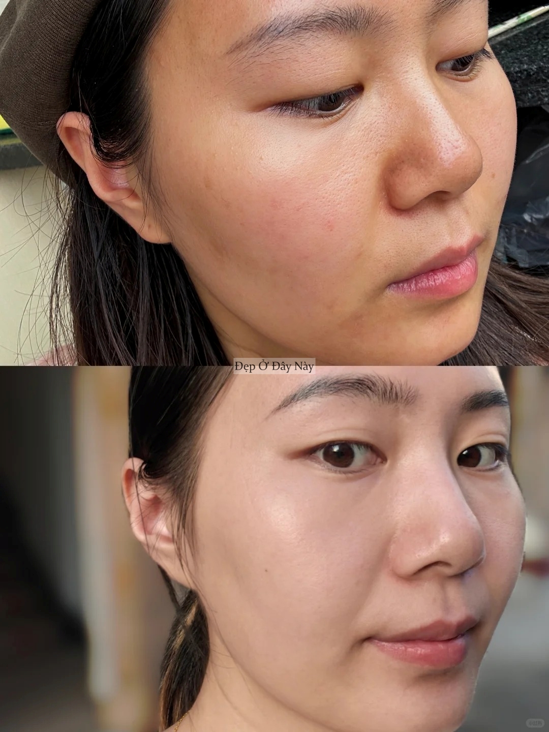 Bác sĩ da liễu không bán sản phẩm mà chỉ đưa chu trình chăm sóc, tôi làm theo và da đẹp lên thật!- Ảnh 6.