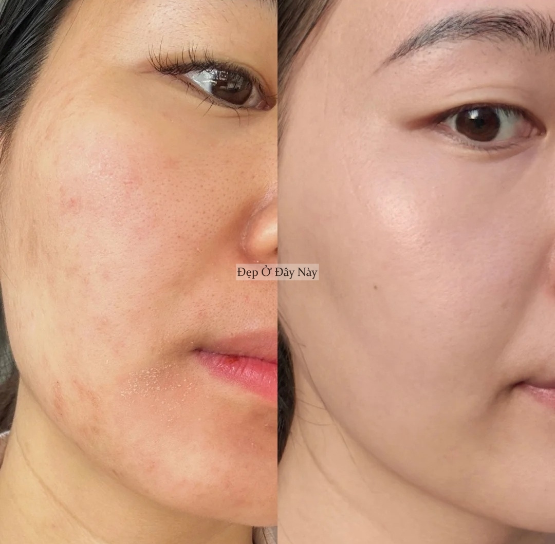 Bác sĩ da liễu không bán sản phẩm mà chỉ đưa chu trình chăm sóc, tôi làm theo và da đẹp lên thật!- Ảnh 5.