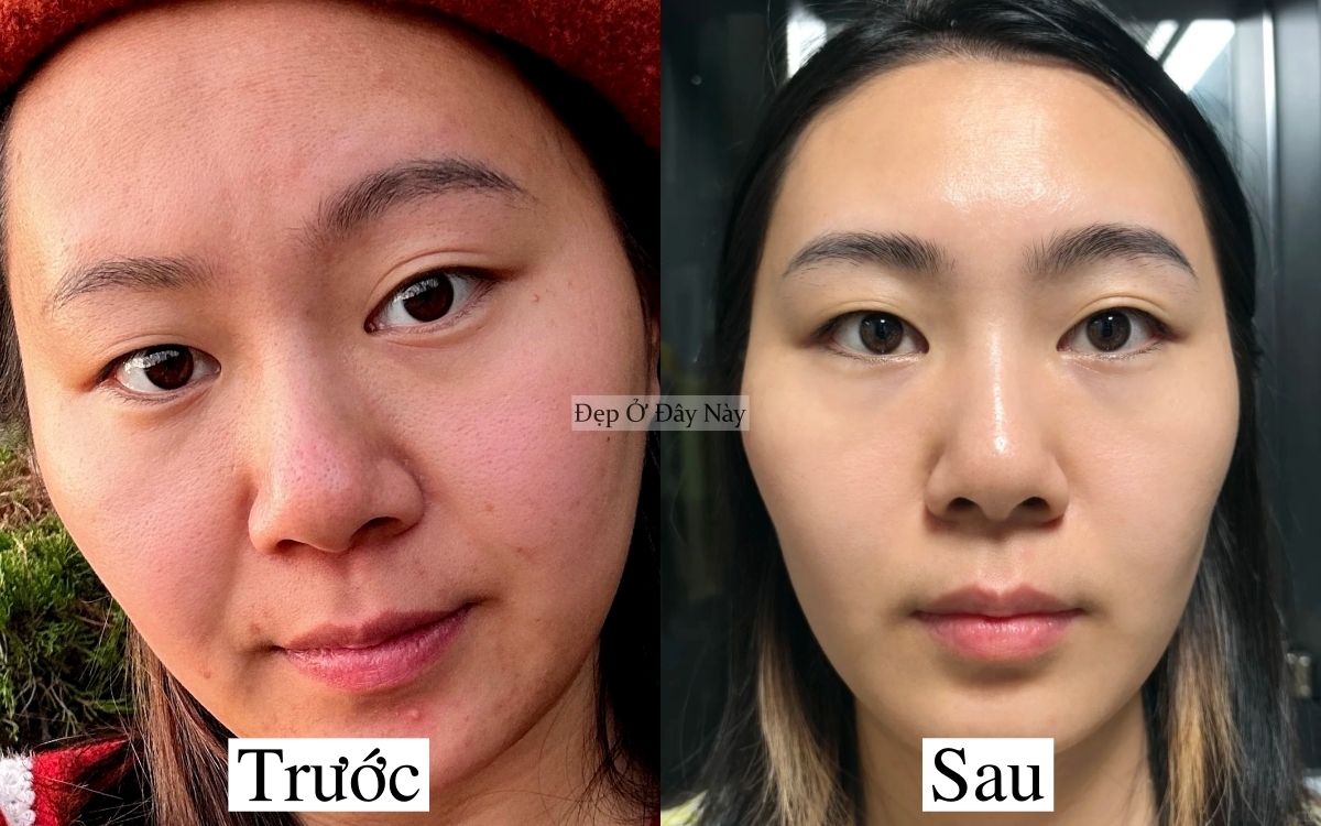 Bác sĩ da liễu không bán sản phẩm mà chỉ đưa chu trình chăm sóc, tôi làm theo và da đẹp lên thật!- Ảnh 2.