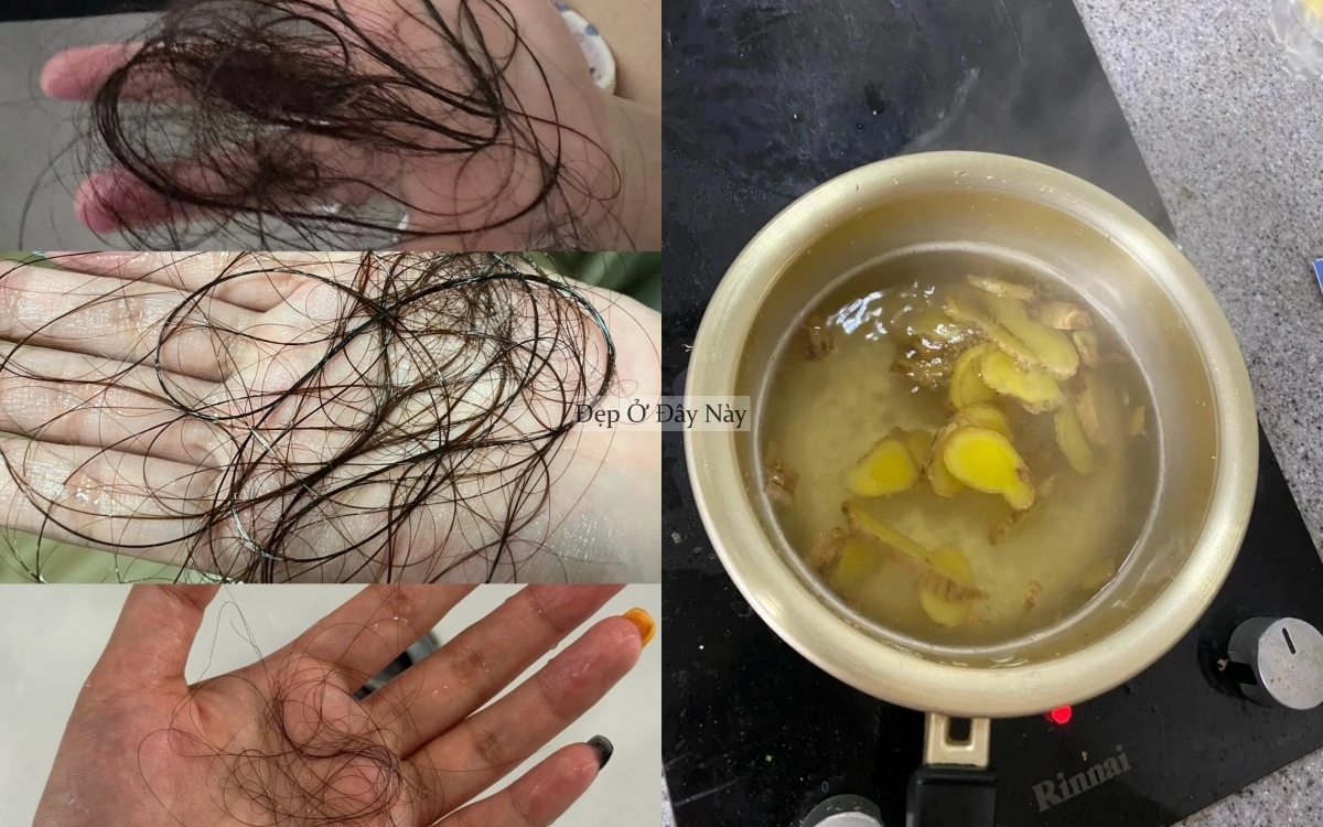 Xu hướng gội đầu với thứ củ rẻ tiền này để giảm rụng tóc thần kỳ- Ảnh 4.