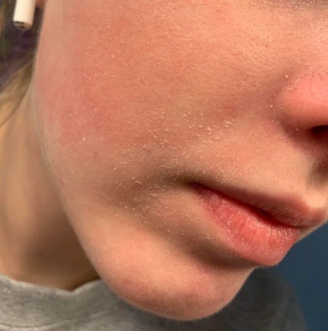 5 thói quen hại da bạn cần bỏ ngay khi trời lạnh, nhất là phụ nữ U40- Ảnh 3.