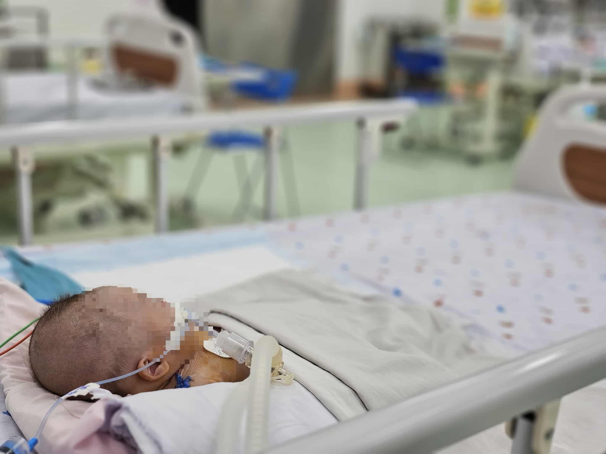 Loại dịch bệnh nguy hiểm diễn biến khó lường, chớ nên chủ quan- Ảnh 2.