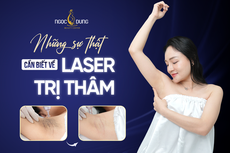 Sự thật về laser trị thâm: Điều bạn cần biết trước khi điều trị- Ảnh 1.