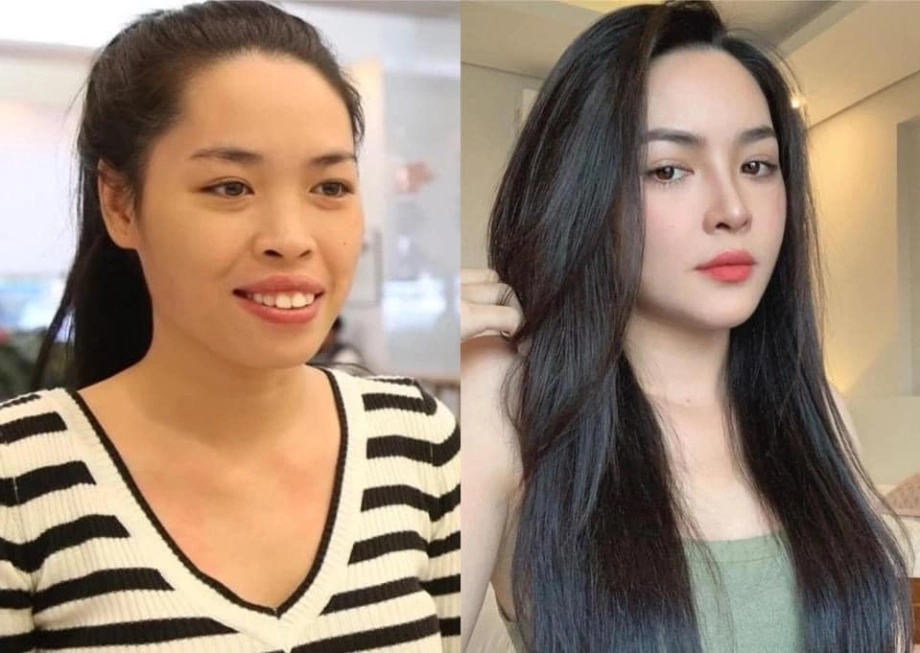 Hot girl thẩm mỹ thành công nhất Việt Nam nói 1 điều không ngờ với phiên bản 10 năm trước- Ảnh 3.