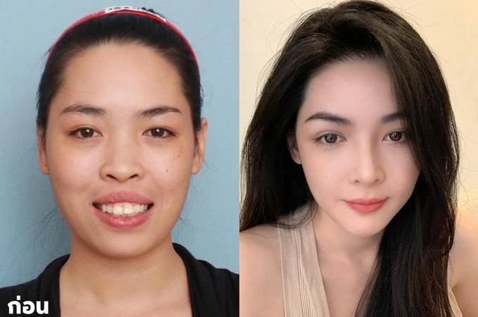 Hot girl thẩm mỹ thành công nhất Việt Nam nói 1 điều không ngờ với phiên bản 10 năm trước- Ảnh 2.