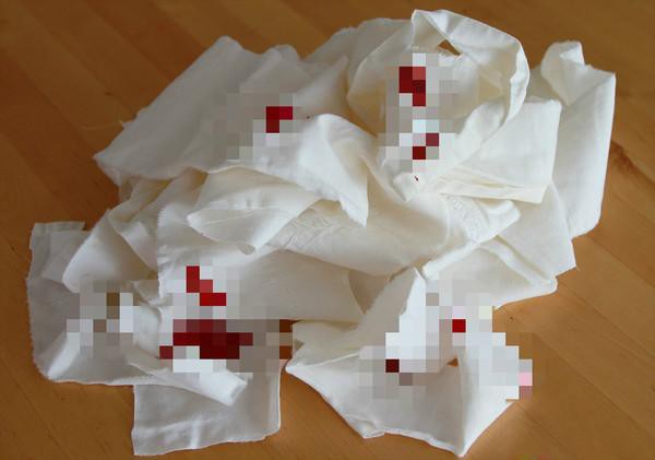 4 tín hiệu tử cung bị bệnh tật đeo bám, ung thư "rình rập" nhiều chị em có mà KHÔNG biết- Ảnh 2.