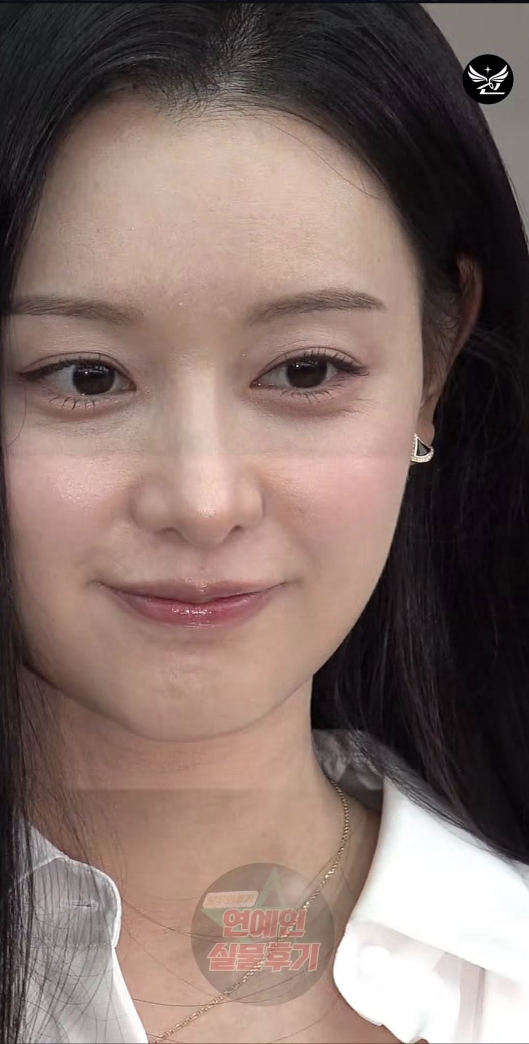 Chùm ảnh da thật của đại đội sao Hàn: Người tổn thương là người xem!- Ảnh 1. Chùm ảnh da thật của đại đội sao Hàn: Người tổn thương là người xem!- Ảnh 1.