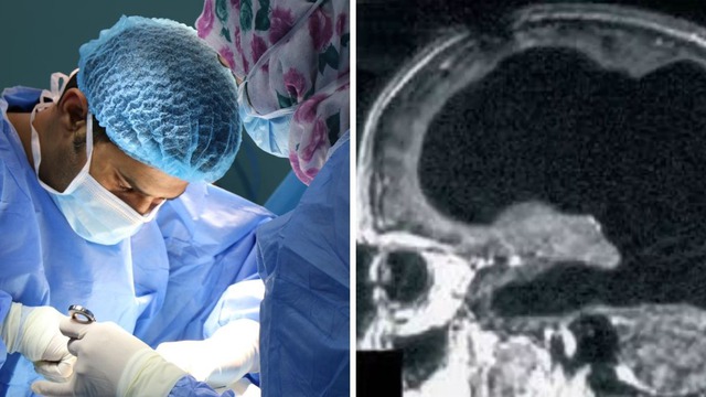 Bí ẩn về người đàn ông mất 90% não, nhưng vẫn có thể sống một cuộc sống bình thường- Ảnh 3.