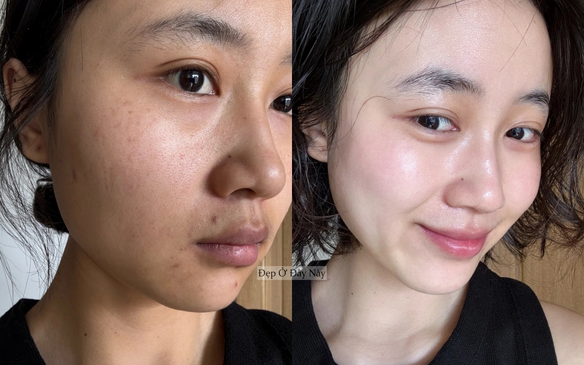 Tôi không skincare cầu kỳ, chỉ ngủ sớm và dưỡng dầu là làn da đã lột xác ngoạn mục!- Ảnh 5.