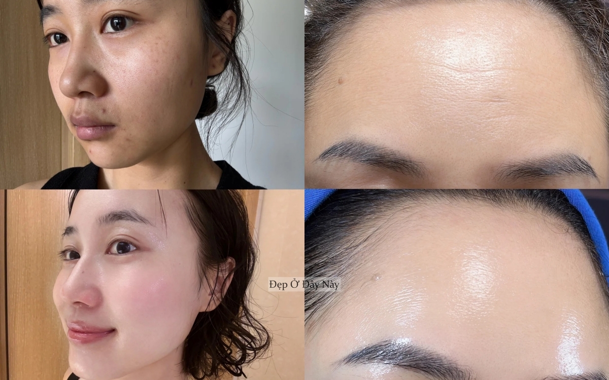 Tôi không skincare cầu kỳ, chỉ ngủ sớm và dưỡng dầu là làn da đã lột xác ngoạn mục!- Ảnh 4.