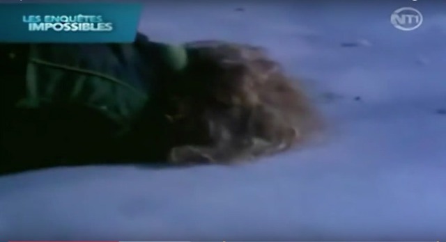 Bị đông cứng như băng suốt 6 giờ ở -30 độ C, người phụ nữ này đã bất ngờ sống lại như trong phim- Ảnh 3.