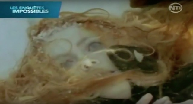 Bị đông cứng như băng suốt 6 giờ ở -30 độ C, người phụ nữ này đã bất ngờ sống lại như trong phim- Ảnh 4.