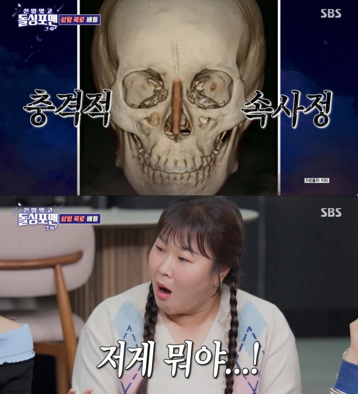 Chưa từng có tiền lệ: Sao nữ “dao kéo” công khai ảnh chụp CT silicon trong mũi trên sóng truyền hình- Ảnh 3. Chưa từng có tiền lệ: Sao nữ “dao kéo” công khai ảnh chụp CT silicon trong mũi trên sóng truyền hình- Ảnh 3.