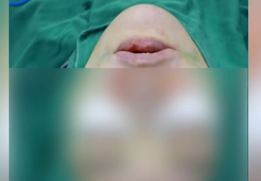 Tin tưởng giao hết 3,7 tỷ đồng tiền tiết kiệm cho bạn gái, chàng trai sốc nặng khi toàn bộ đã "nướng" cho thẩm mỹ viện- Ảnh 2. Tin tưởng giao hết 3,7 tỷ đồng tiền tiết kiệm cho bạn gái, chàng trai sốc nặng khi toàn bộ đã "nướng" cho thẩm mỹ viện- Ảnh 2.