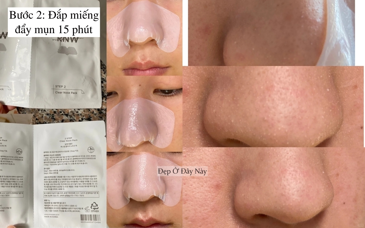 Ở tuổi 27, tôi học được cách làm sạch mụn đầu đen ở mũi hiệu quả, làm 1 lần là "nhẵn thín"- Ảnh 3.