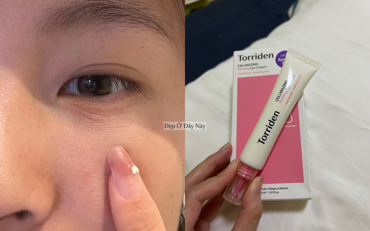 Vùng da "phú bà" mà nhiều chị em thường bỏ qua khi dưỡng da- Ảnh 4.