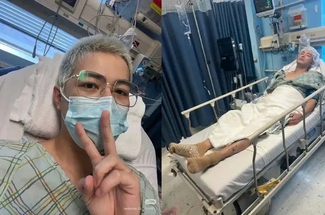 Bi kịch sau cú ngã khiến nam diễn viên bị xe tải cán nát chân, 2 năm lên bàn mổ để giữ mạng- Ảnh 2.