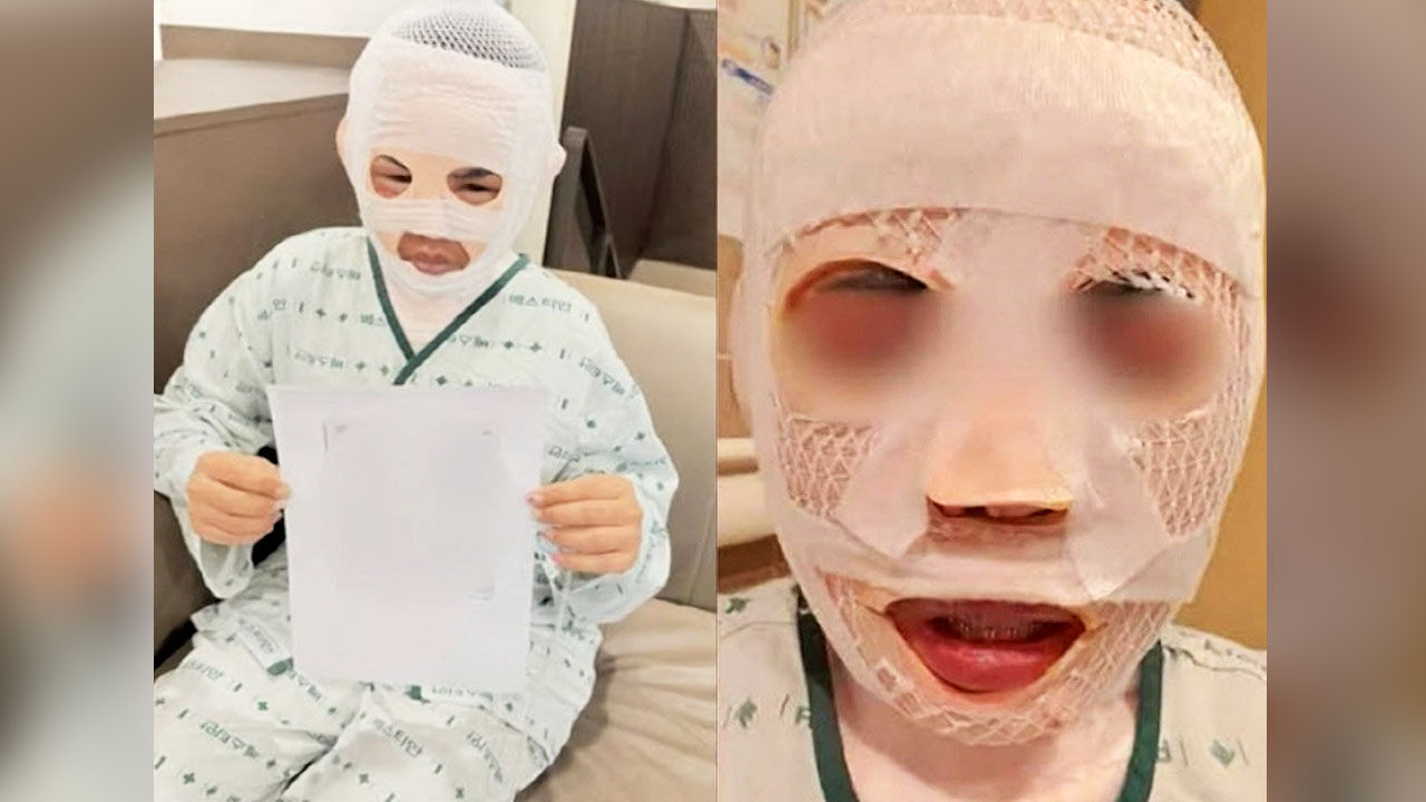 Vợ đang ngủ bị chồng tạt nước sôi vào mặt để huỷ dung vì sợ "gặp người đàn ông khác"- Ảnh 1. Vợ đang ngủ bị chồng tạt nước sôi vào mặt để huỷ dung vì sợ "gặp người đàn ông khác"- Ảnh 1.