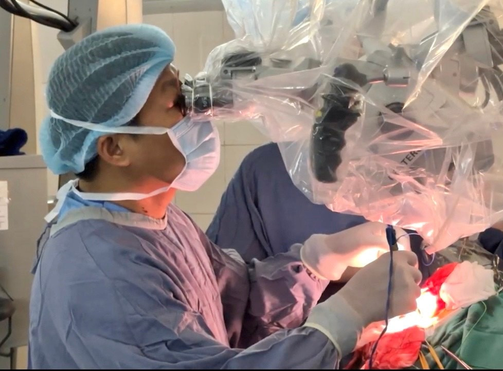 Hi vọng mới cho hơn 200.000 bệnh nhân động kinh kháng thuốc- Ảnh 2.