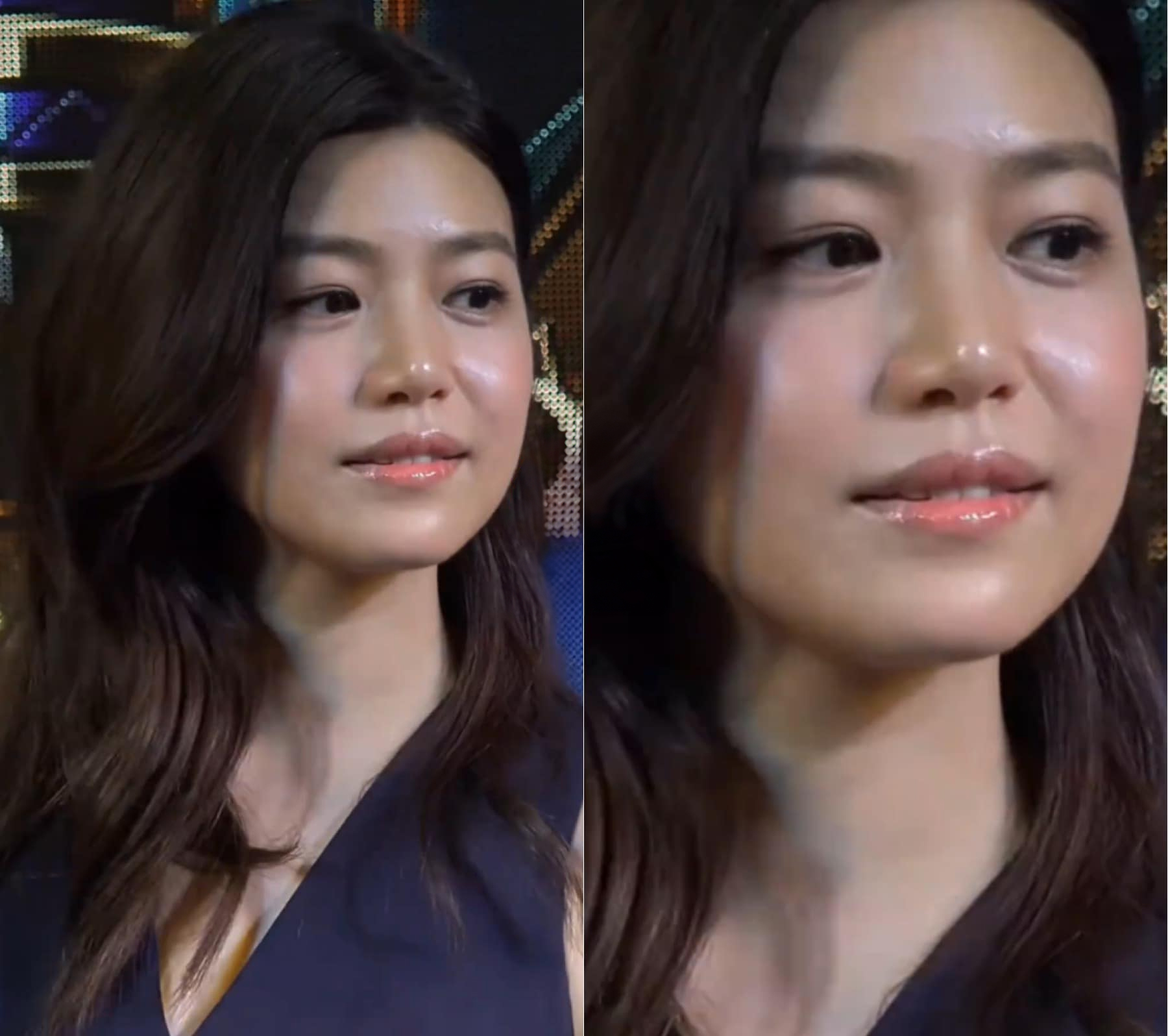 Tình trạng da khó tin của Trần Nghiên Hy- Ảnh 1.