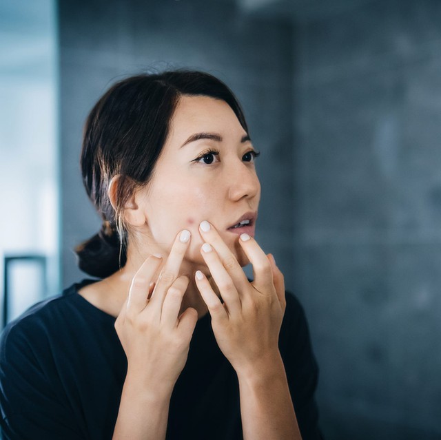 Cứ đổ lỗi cho stress, ai ngờ nguyên nhân mệt mỏi, da xấu, tóc rụng là do thiếu dưỡng chất này: 8 dấu hiệu phụ nữ rất dễ gặp- Ảnh 4.