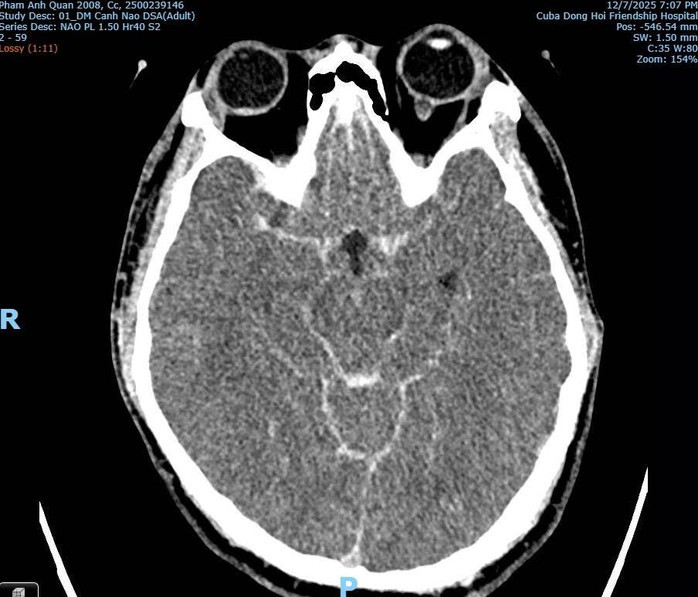 Phân tích y khoa vụ thiếu niên tử vong sau xô xát tại quán bida ở Quảng Trị- Ảnh 2.
