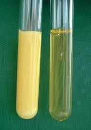 Huyết tương đục như mỡ, người đàn ông nguy kịch vì uống nửa lít rượu mỗi ngày- Ảnh 1.