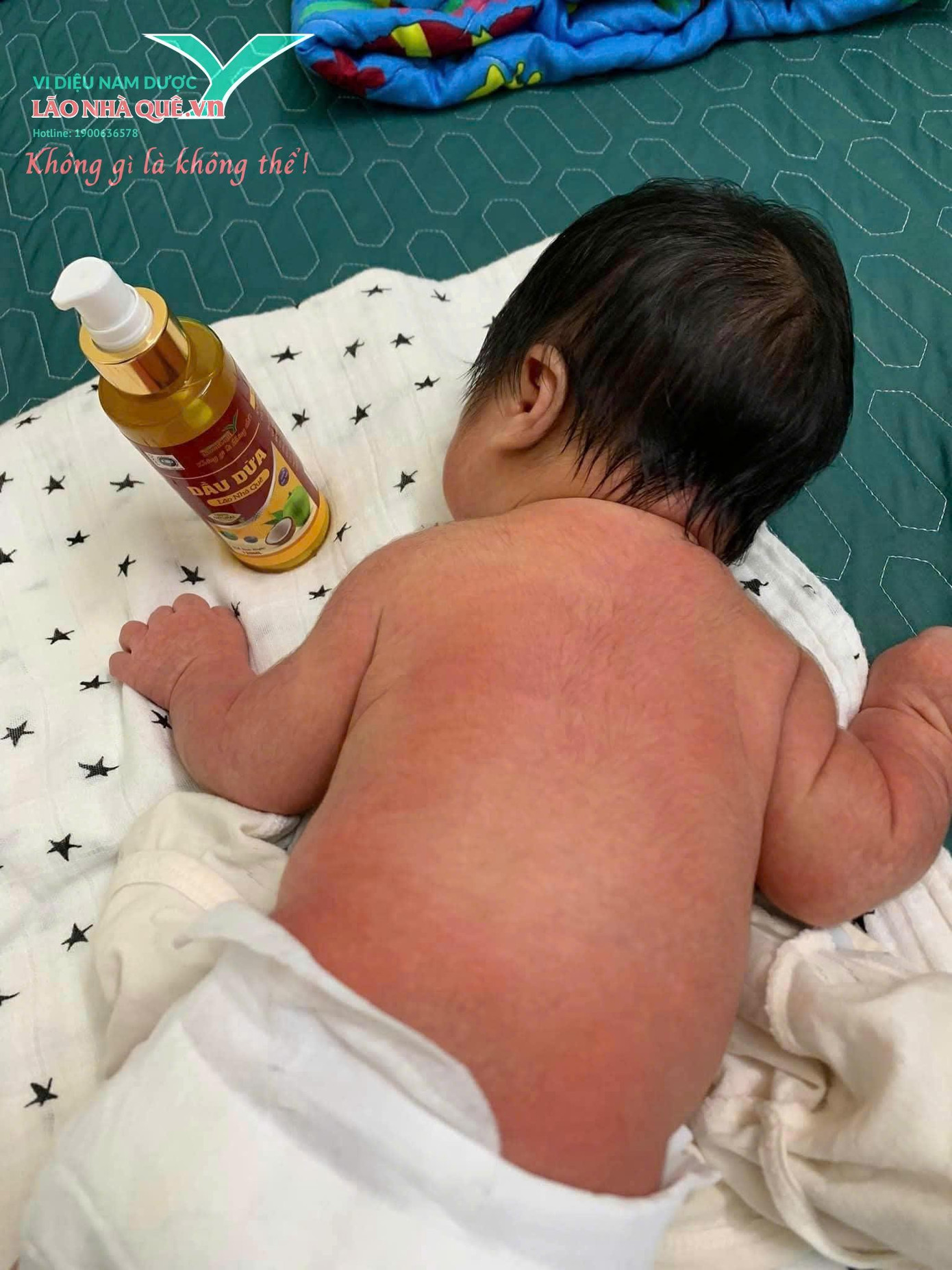 Giải pháp tự nhiên cho da khô nứt nẻ, chai sần chỉ từ dầu dừa và nước muối ấm- Ảnh 2.