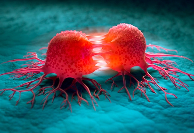 Bác sĩ Mỹ chia sẻ 5 món ăn nhẹ làm tăng khả năng chống ung thư ruột kết gấp bội, ban đầu thấy lạ nhưng “càng ăn càng mê”- Ảnh 1.