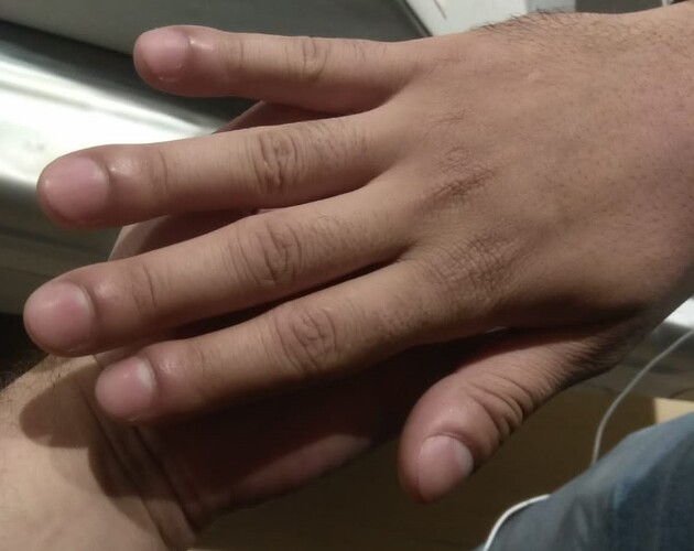 Rõ ràng bị đau vai nhưng bác sĩ lại báo mắc ung thư phổi, người đàn ông gào khóc: “Sai ở đâu?”- Ảnh 3. Rõ ràng bị đau vai nhưng bác sĩ lại báo mắc ung thư phổi, người đàn ông gào khóc: “Sai ở đâu?”- Ảnh 3.