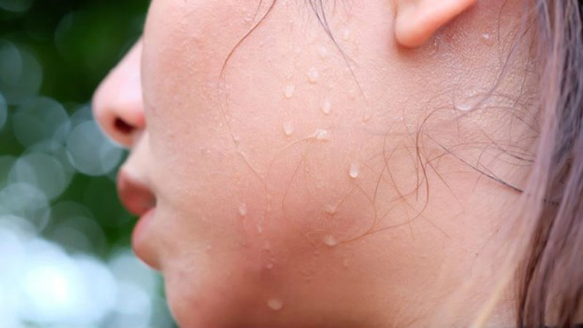 Sinh viên Đại học Bách khoa năm cuối bị basedow nhiều năm, bác sĩ hỏi vẫn không biết mình mắc bệnh gì- Ảnh 1. Sinh viên Đại học Bách khoa năm cuối bị basedow nhiều năm, bác sĩ hỏi vẫn không biết mình mắc bệnh gì- Ảnh 1.